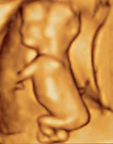 File:Ultrasound image of a fetus.jpg